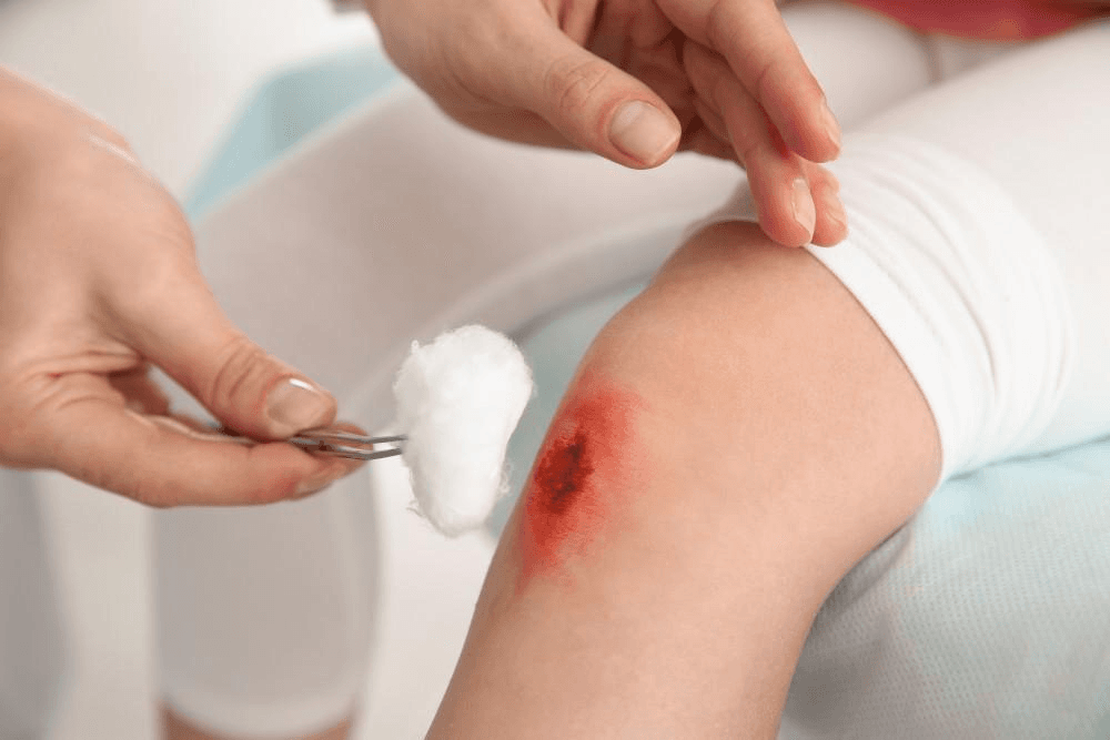 Why Isn't This Wound Healing? Signs It's Time for Wound Care